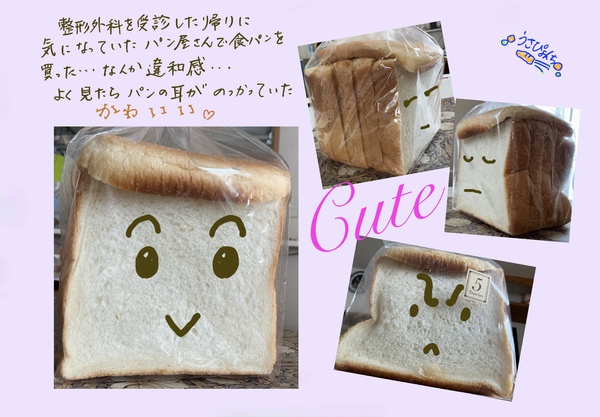 ばね指 ばね指