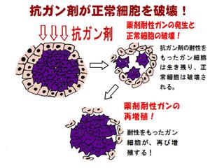 癌治療について